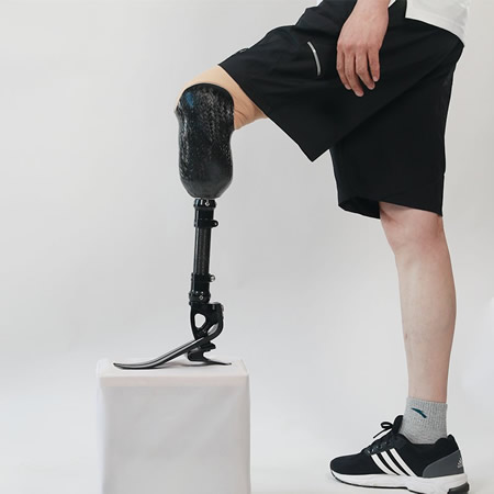 Prosthetic limb